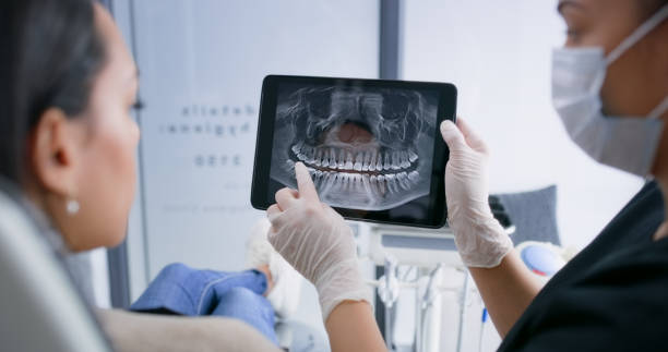 Licensed Wisdom Tooth Removal service in Silver Spring, MD - Smile Center Dentistry